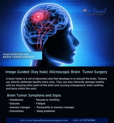 🧠brain Tumor Symptoms And Signs🧠 Brain Tumor Tumor Brain Surgery