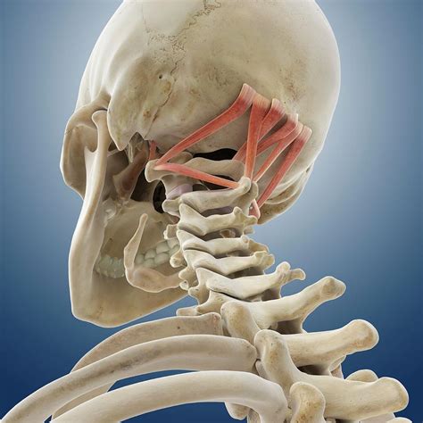 Suboccipital Muscles Photograph By Springer Medizinscience Photo