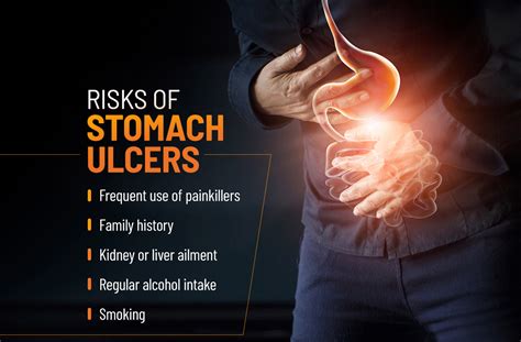 6 Important Signs Of Stomach Ulcer Causes And Treatment Images