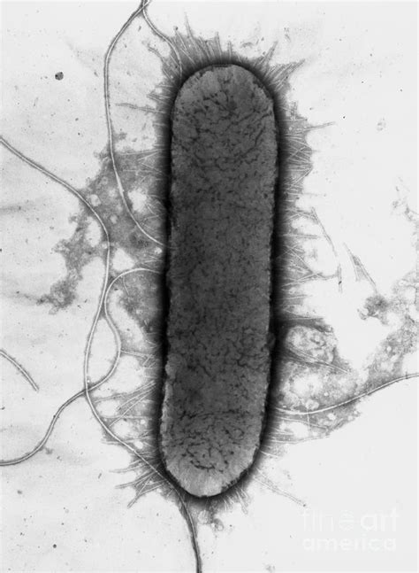 Erwinnia Chrysanthemi Bacterium Photograph By A Dowsett National