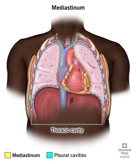 Mediastinal Mass Tumor Types Symptoms Causes Treatment Off