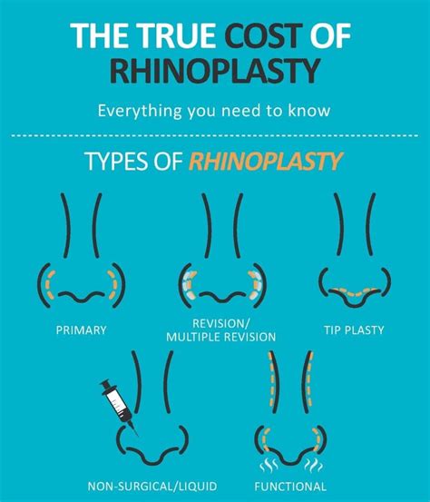 What Is The Cost Of A Rhinoplasty Philip Miller Md Facs