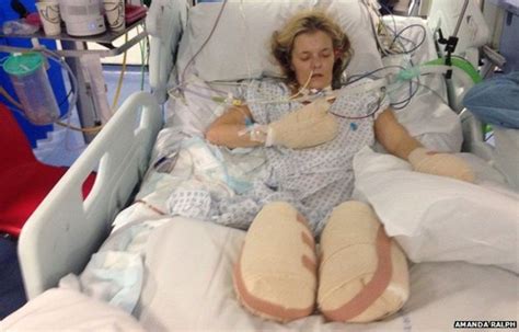 Astonishing Donations For Leg Amputee Mum Tracy Ralph Bbc News