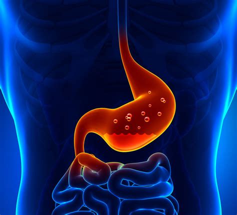 Zapalenie żołądka Przyczyny objawy i leczenie Porady w INTERIA PL
