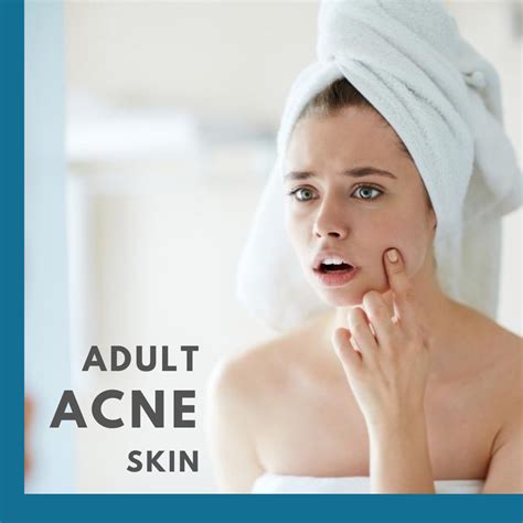 Adult Acne Control Treatment Beauty Grace
