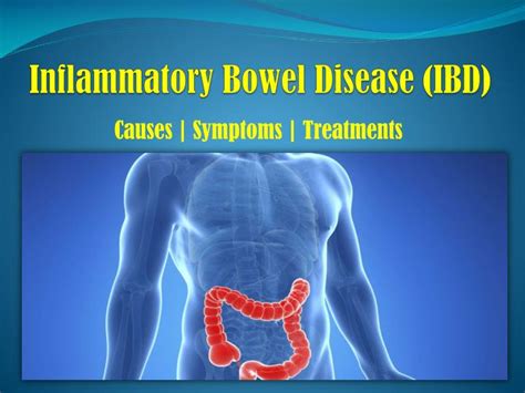 Ppt Inflammatory Bowel Disease Problem That Occurs In The