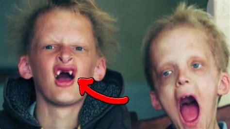 Ces Enfants Ressemblent De V Ritables Vampires Youtube