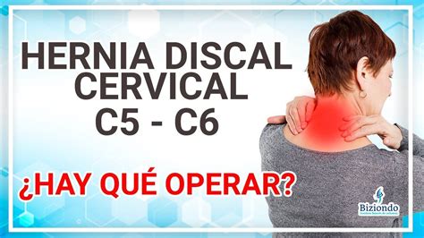 Hernia Discal C C Izquierda