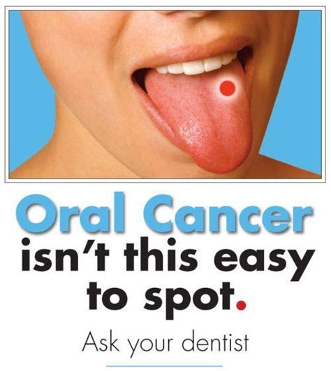 Dentist Guelph On Do The Doctors Check For Oral Cancer