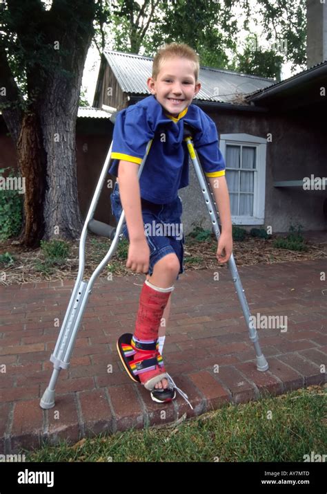 This Young Man Doesnt Let A Colorful Leg Cast Or Crutches Slow Him