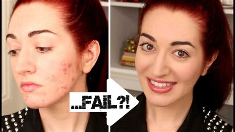 How to use up eyeshadow quickly. HOW TO: Quickly Cover Acne & Scarring! 5 Minute Makeup Challenge FAIL?! - YouTube