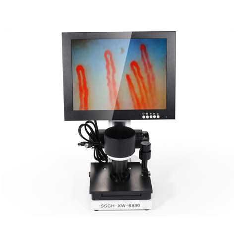 Easily convert inches to centimeters, with formula, conversion chart, auto conversion to common lengths, more. Portable 10 Inch LED Display Nail Fold Capillaroscopy ...