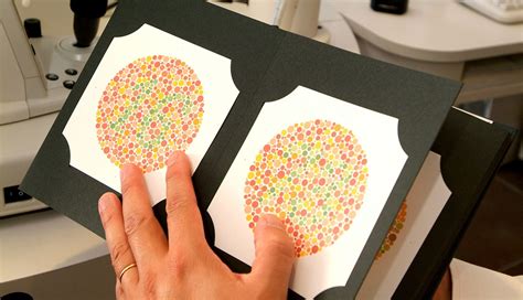 Guide To Treat Color Blindness Naturally Symptoms Causes Types