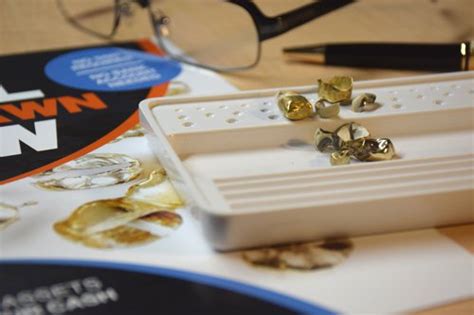 Sell dental gold online - Sell gold crowns & dental scrap