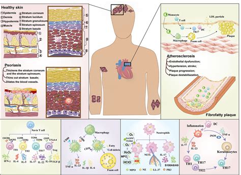 Frontiers Immunity Psoriasis Comorbid With Atherosclerosis