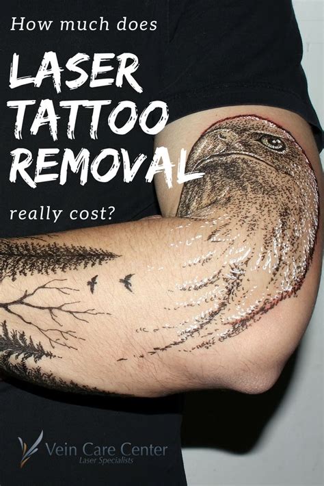 Our teachers have been working in this sector for many years, and are skilled at imbuing our students with a thorough understanding of the theory, as well as building confidence in giving these treatments at our practicals. How Much Does Laser Tattoo Removal Really Cost? | Tattoo ...