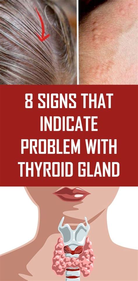 8 Signs That Indicate Problem With Thyroid Gland Garden By Yourself