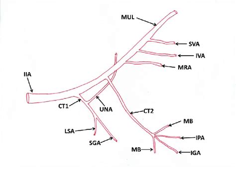 The exact arrangement of branches of the internal iliac artery is variable. Schematic diagram of variant branches of the internal ...