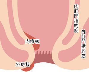 和歌山県橋本市で肛門疾患の治療なら ｜ いわくらクリニック ...