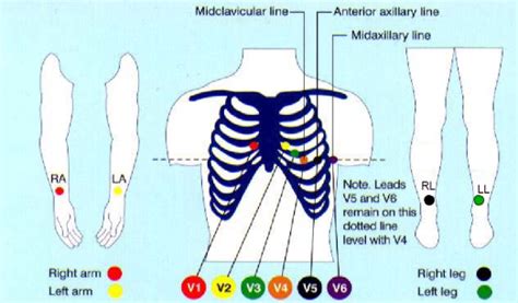 Picture Of 12 Lead Ecg Placement Rc Nachtflug Photos Real Pictures Of