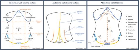 Figure Surface Anatomy And Abdominal Wall Incisions Contributed By