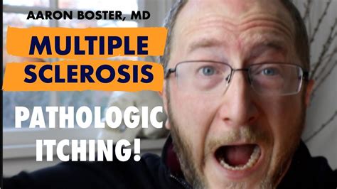 Multiple Sclerosis Rare Symptom Pathologic Itching With Ms Youtube
