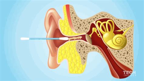 1.1 to clean your ears at home naturally by. Why you shouldn't use Q-Tips to clean out earwax -- and ...