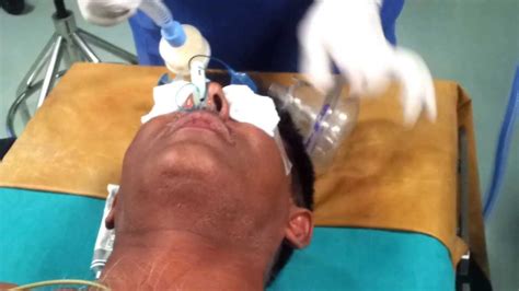 Blind Nasal Intubation Youtube