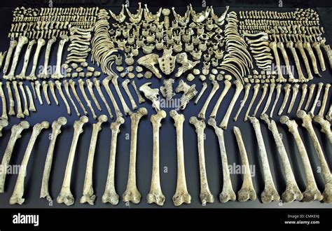 5000 Year Old Human Bones Are On Display In The Exhibition In The