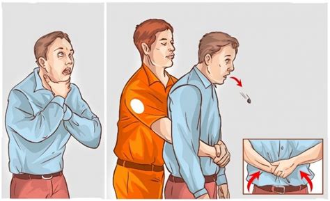 Heimlich manevrasını uygulamak için kişiye ayakta veya oturur pozisyonda arkadan sarılın. Heimlich Manevrası Nedir? Önemi