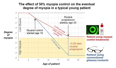 Bay Eye Care — Myopia Control Slowing Short Sightedness