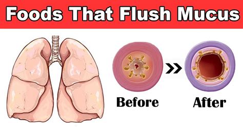 8 Foods That Flush Mucus From Your Body How To Get Rid Of Mucus In