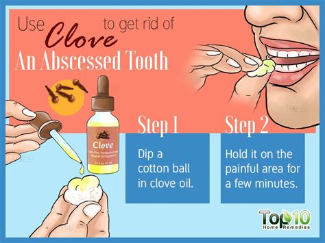 tooth abscess 10 home remedies to help manage the infection top 10 home remedies