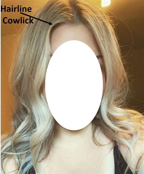 Do You Know Most Of Us Have Cowlick In Our Hair Hera Hair Beauty