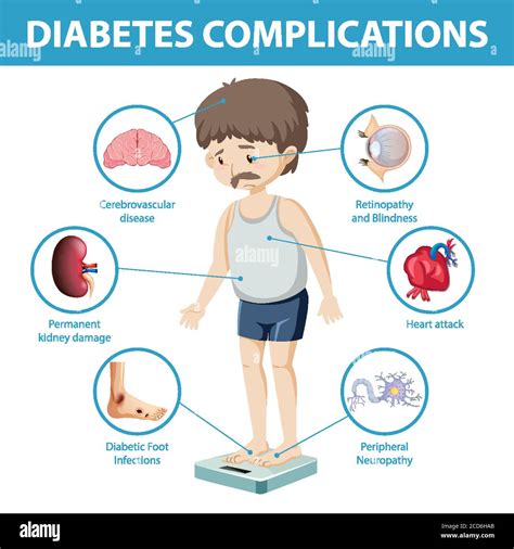 Diabetes Complications Information Infographic Illustration Stock Hot