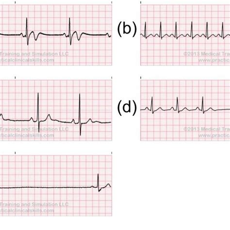 Performance Of Various Ensemble Of Depthwise Separable Cnn