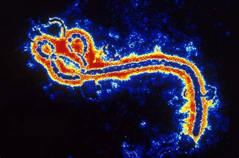 Texas Man Has First Ebola Case In Us