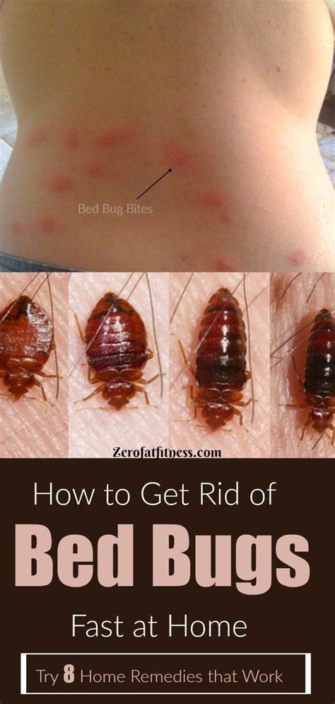 How To Get Rid Of Bed Bugs Fast 8 Home Remedies That Work Rid Of