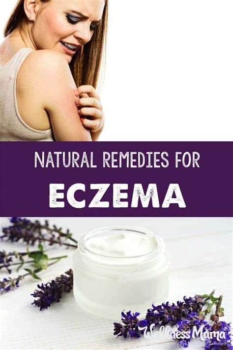 7 Natural Remedies For Eczema Eczema Remedies Natural Remedies