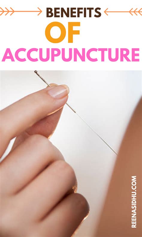 The Many Benefits Of Acupuncture In 2020 Acupuncture Benefits