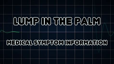 Lump In The Palm Medical Symptom Youtube
