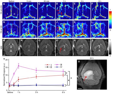 Pact And Mri Of Mouse Brain In Mcao Model At An Early Stage In Vivo