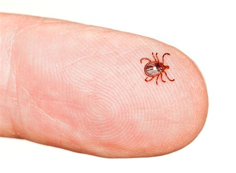 7 Weird Symptoms Of Lyme Disease