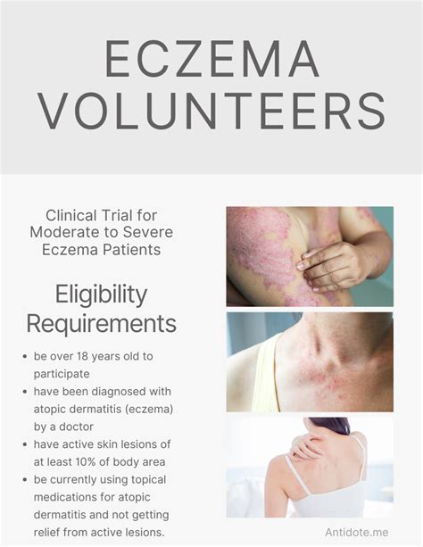 Calling Moderate To Severe Eczema Patients