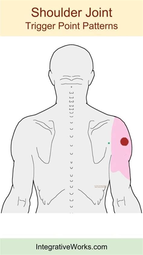 Shoulder Pain Location Chart