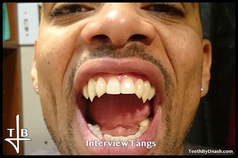 Interview Teeth By Dnash