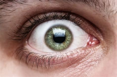 Bosnian Grandmother Licks Eyeballs Cures Ailments