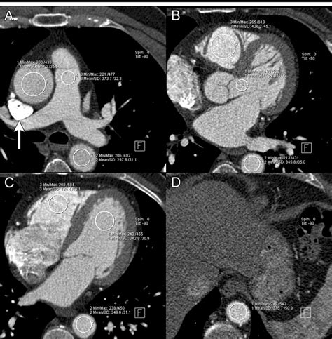Transverse Ct Sections Acquired At Different Levels During Main