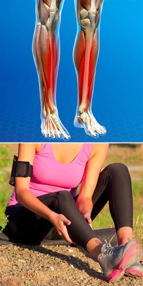 Medial Tibial Stress Syndrome Exercises