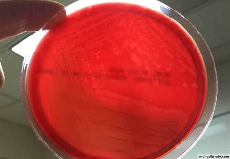 Listeria monocytogenes is the species of pathogenic bacteria that causes the infection listeriosis. Listeria Monocytogenes pptx - D. Zainab - Muhadharaty